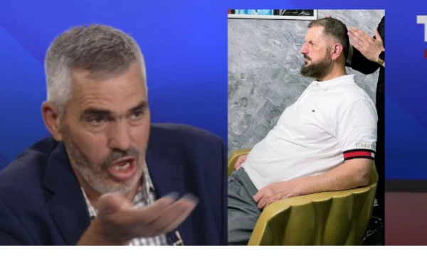 Mulla Osmani e komenton mbjelljen e flokëve të Shefqet Krasniqit