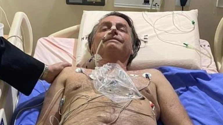 Presidenti brazilian dërgohet në spital, nuk i pushonte lemza prej 10 ditësh