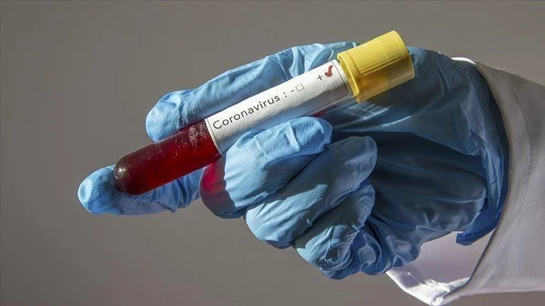 3 nouveaux cas avec COVID-19 au Kosovo, aucun mort