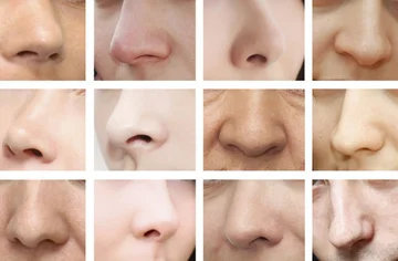 How to escape trapped noses without using any medicine