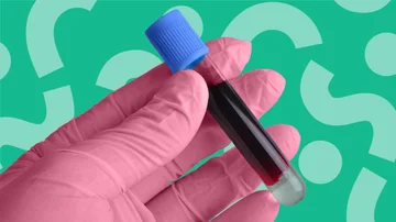 These symptoms indicate anemia