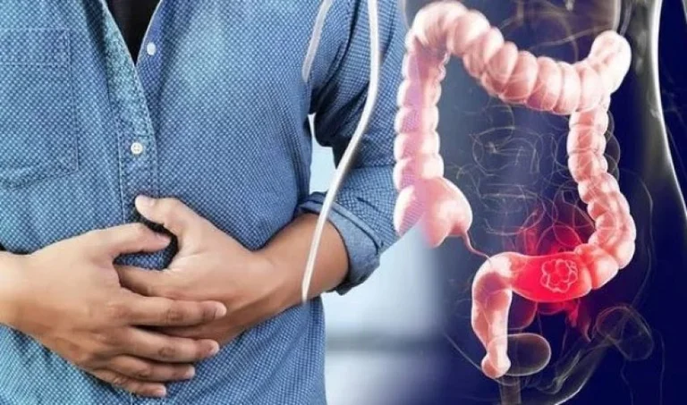 Simptomat e kancerit: Tri ndryshime të mëdha mund të sinjalizojnë rrezikun për sëmundjen vdekjeprurëse