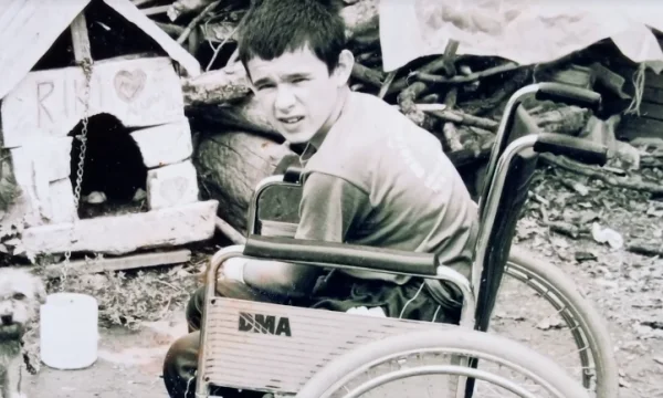 L'histoire touchante du Kosovo qui a marché sur la mine a perdu sa jambe et sa main alors qu'il n'avait que 12 ans.