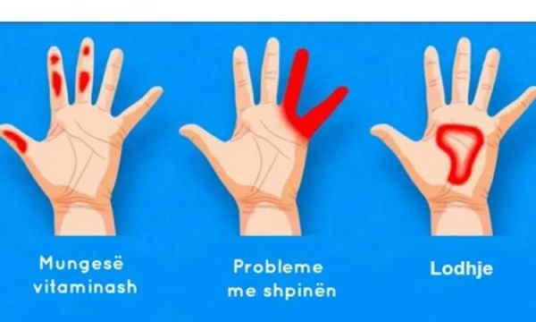 Estas son enfermedades ocultas en la palma de la mano