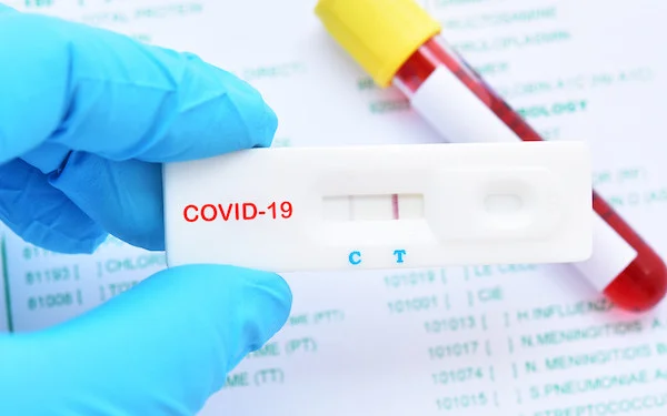 David-19 en Albanie, 12 nouveaux cas et 1 décès
