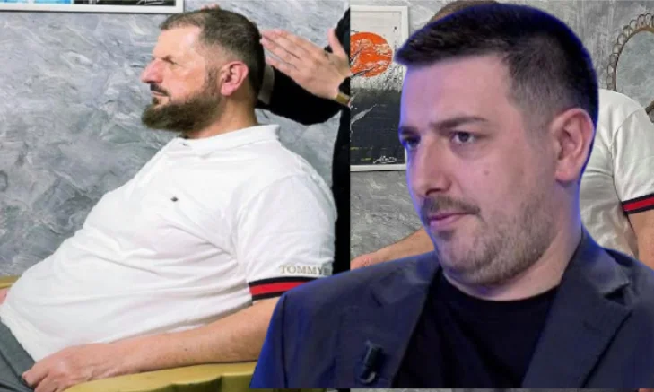 The eye indicates that Shefqet Krasniqi has planted hair, asks whether religion allows it