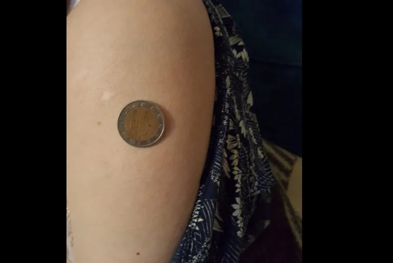 L'étrange plainte du Kosovo: La famille qui a pris un vaccin anti-VID CO, oui à “kapen” pièces comme aimant