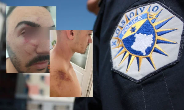 We've been beaten to the ground by four young men denouncing police for brutal violence in Gjilan