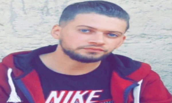 25-year-old Ferizaj suffers from serious illness, family seeks help