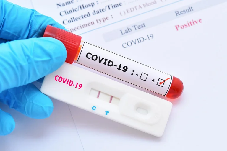 Professor Ali Shabanaj needs post-Covid blood plasma
