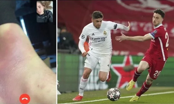 Ver: La estrella del Real Madrid jugó lastima y dolorosamente contra Liverpool