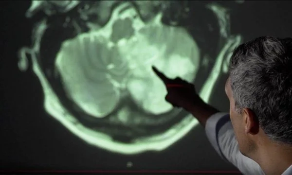 Study: One in three patients with Cold 19 is diagnosed with mental problems
