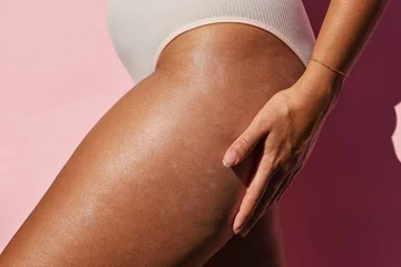 Facts you didn't know about cellulite.