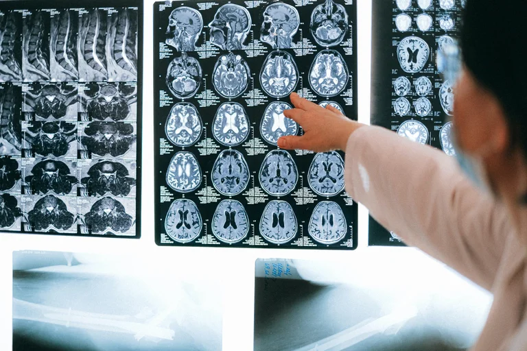 An unknown disease? The mysterious symptoms in the brain surprise doctors