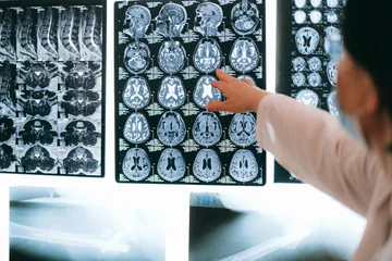 An unknown disease? The mysterious symptoms in the brain surprise doctors