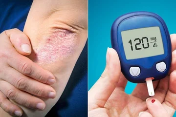 Finden Sie heraus, wie sich Diabetes in Frauen und Männern verändert