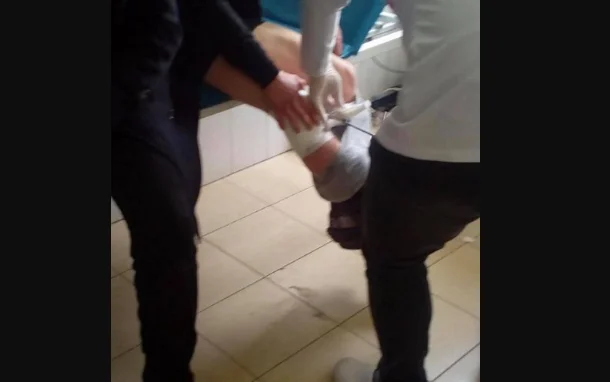 Tmerr në Suharekë: Qeni i tërbuar ngjitet në katin e katërt dhe i sulmon, familjarët e mbysin me thikë