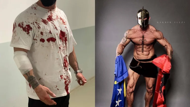 Image published where people attack bodybuiders from Gjilan