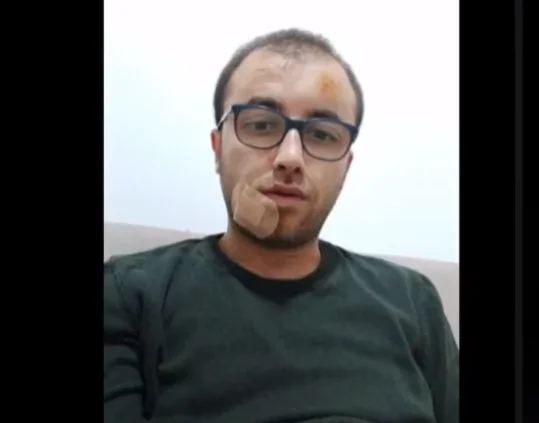 Duriqi shows his state of health, says he had expected the attack