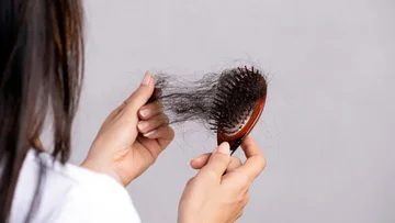 Study: One in four Twitter patients suffer from hair loss, women are most endangered