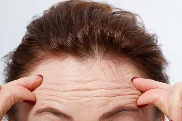 How to get rid of face wrinkles by not spending money