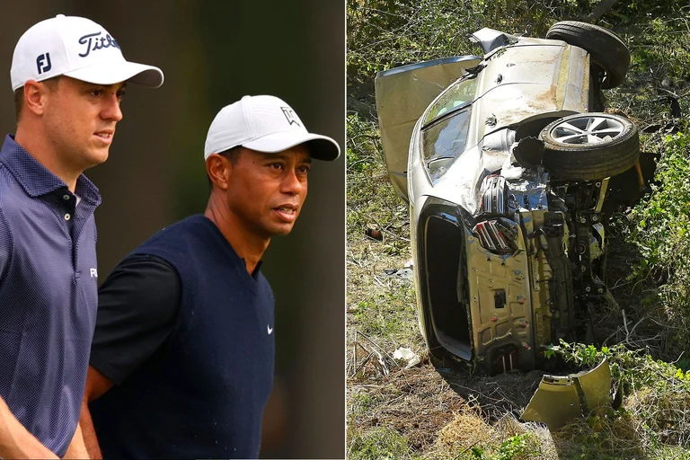 Kjo është gjendja e Tiger Woods pas aksidentit të frikshëm