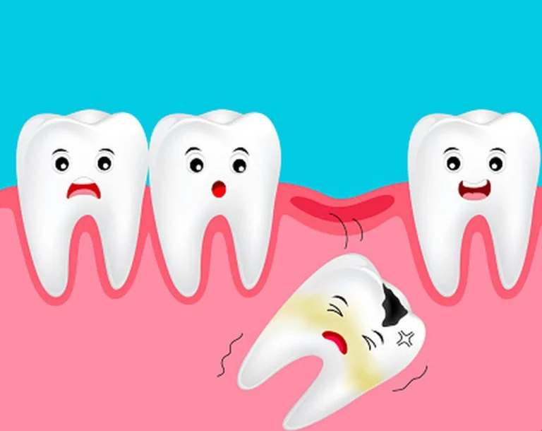 ¿Cómo puede entender cuando debe (o no) quitar los dientes de madurez