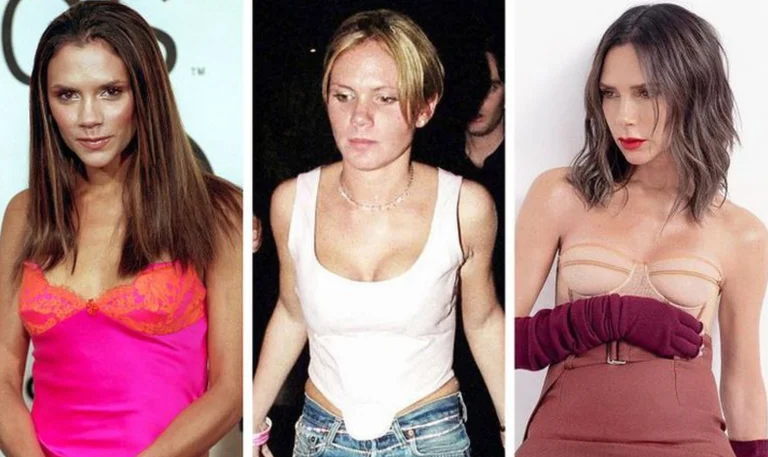 14 célébrités qui ont fait une intervention esthétique et les ont acceptées !