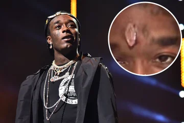Comme promis, le rappeur connu met 24 millions de dollars dans son front