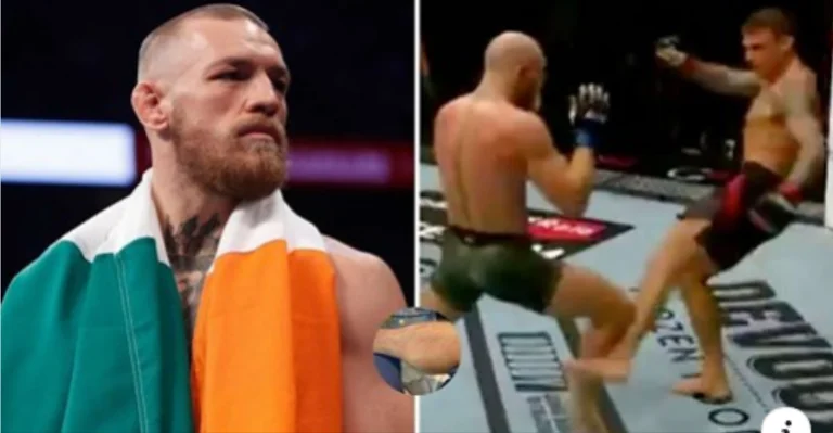 Conor McGregor mostra quello che la sua gamba sembra 12 giorni dalla perdita a Dustin Poirier.