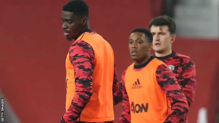 Manchester United denoncon ashpër abuzimin racist të tifozëve ndaj lojtarëve të saj