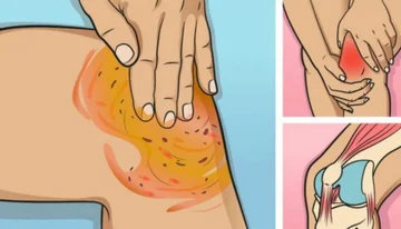 People are “remembering” for this recipe! It turns the pain on your knees and knots...