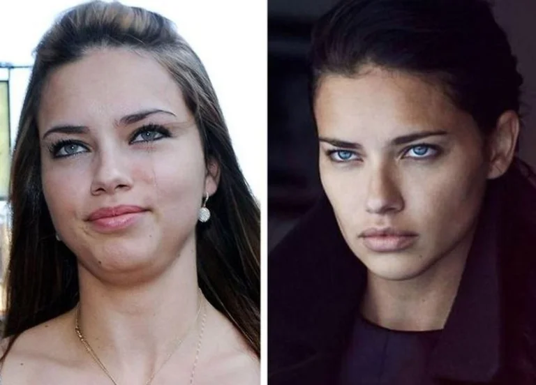 The trend of the jaw and cheekbones highlighted: V IPs before and after