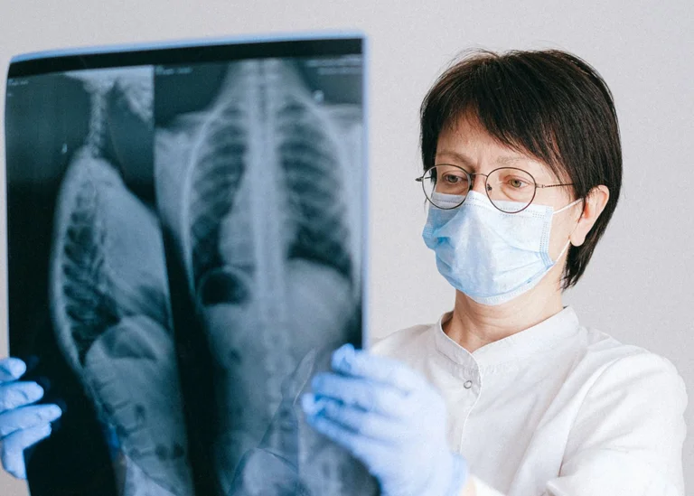 Post-Cavid: El estudio revela que estos síntomas persisten 6 meses después de la infección