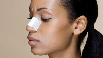 Rhynoplastics: 5 things I'd like to know before I interfered with my nose