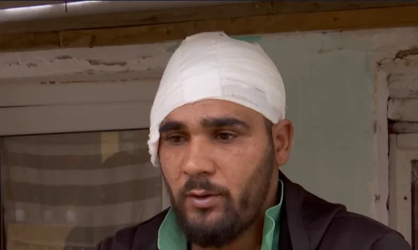 Janjevo: Two minors hit him with saki on the head, the victim relates the story