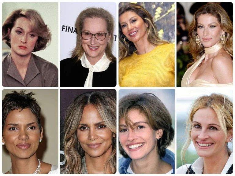 6 Renowned women show why they have refused to perform botox and plastic surgery