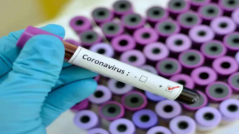 Oltre 74 milioni di persone infettate nel mondo da COVID-19, circa 1,7 milioni di morti