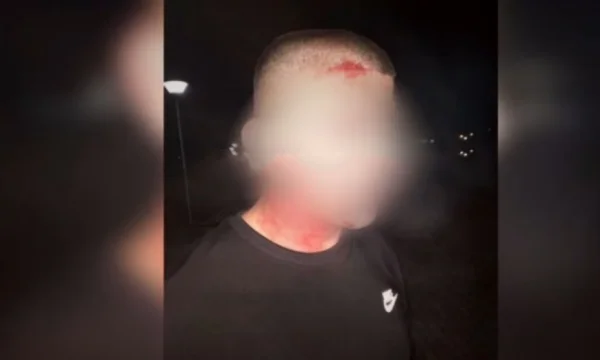 19-year-old man bleeding in Mitrovica for police watch violations