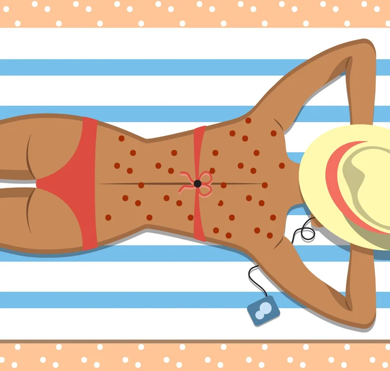 With these methods you can get the acne off your back