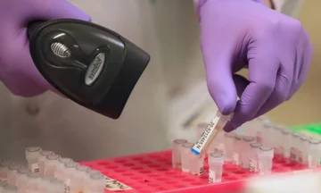 Diese Blutgruppen leiden am meisten am COVID-19 Virus