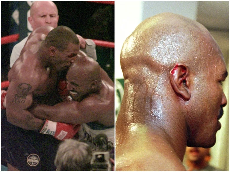 It's Mike Tyson's story about the duel against Hollyfield: I bit him in the ear because I wanted to kill him.