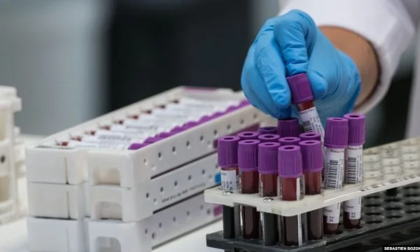 One in four tested in Kosovo has emerged infected with coronary