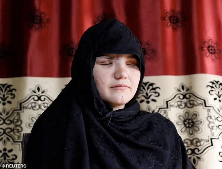 33 Jahre alt in Afghanistan stares, nachdem sie von der Polizei eingestellt wurden