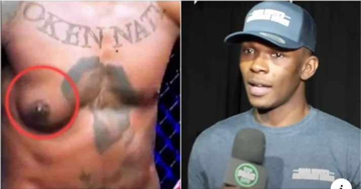 Le guerrier de l'UFC dit que l'excès de marijuana a causé cette déformation dans le corps