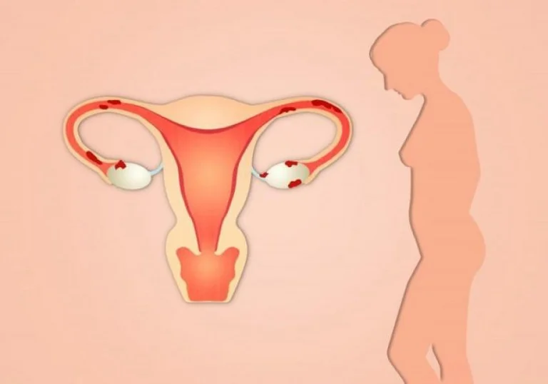 Ein Zeichen von Krebs: Was sollten Frauen nach den Wechseljahren ignorieren?