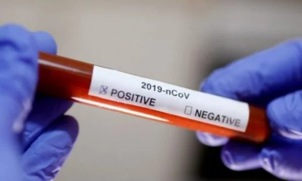 275 raste të reja me koronavirus në Kroaci