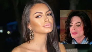 Vous ressemblez à Michael Jackson, l'ancienne petite amie de Robert Berisha réagit durement au poursuivant.