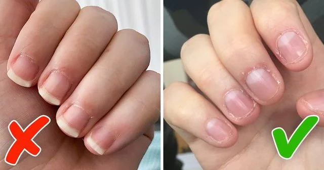 4 consejos prácticos y accesibles para dejar de comer uñas