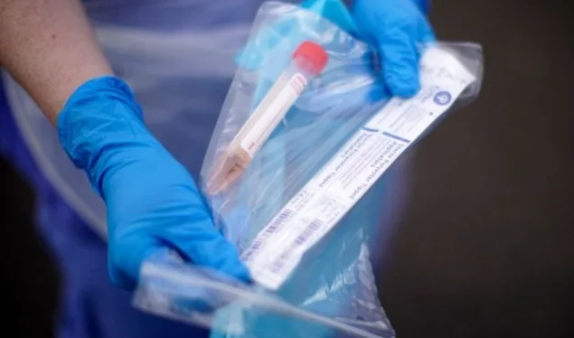 Eslovenia con nuevo registro Coronavirus